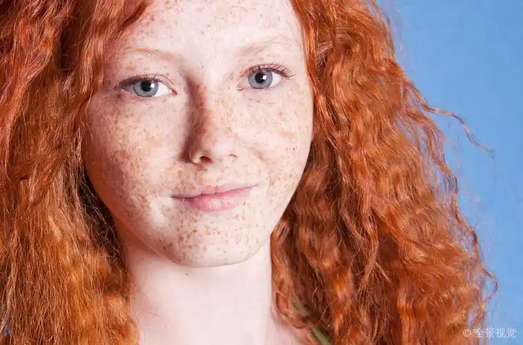 愉悦_雀斑_女孩_图片大全—全景创意图库(quanjing.