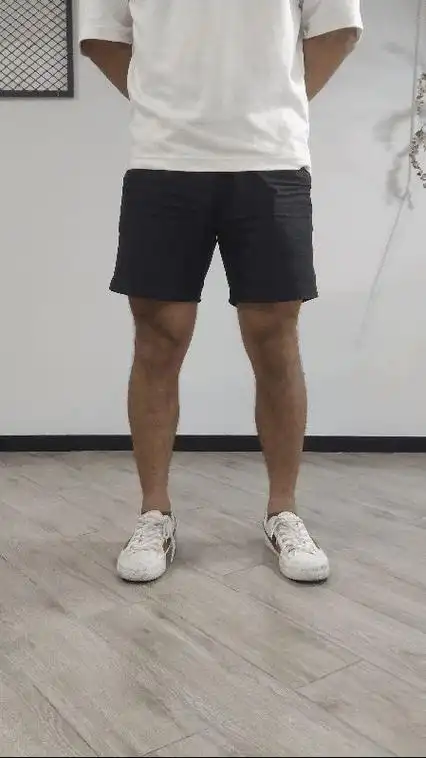 这样的腿算是x型腿吗应该如何矫正