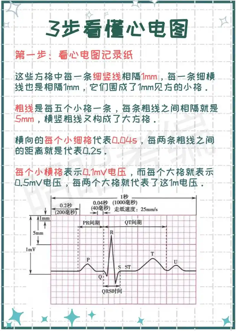 只需3步手把手带你看懂心电图7315看完不会找我#医学生 #知识