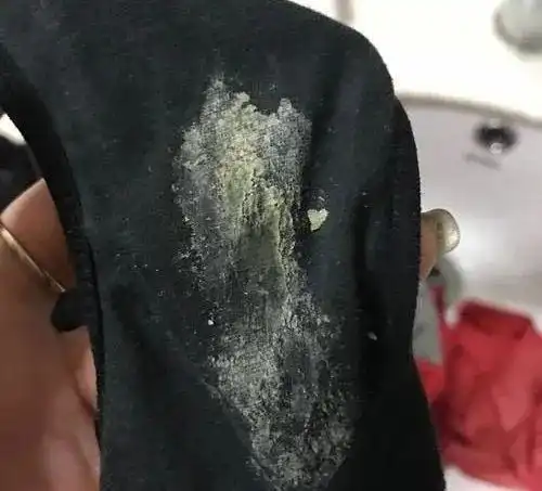 女生的内裤到底有多脏多长时间换一次比较科学女性建议了解下