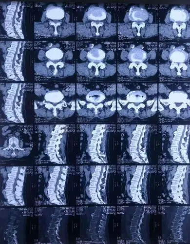 奋飞的骨科 十一月份第三期