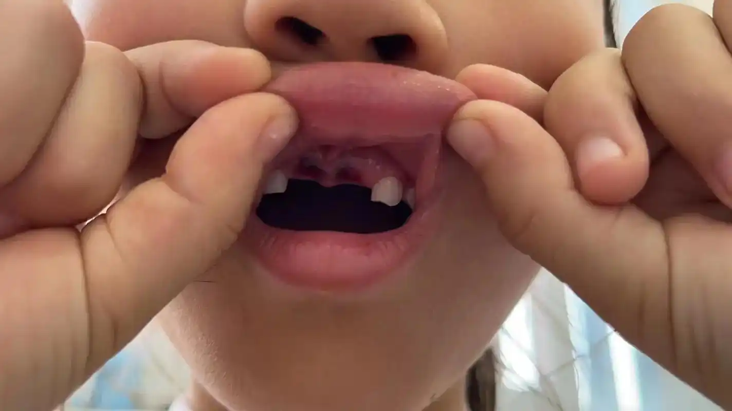 今天接到老师的电话说小朋友在一起玩,不小心把你