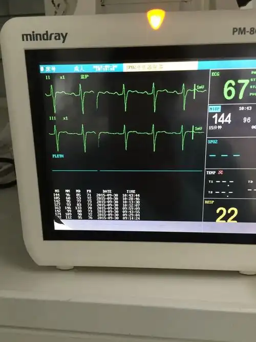 她的心电图为什么和正常人的不一样,qrs波群?