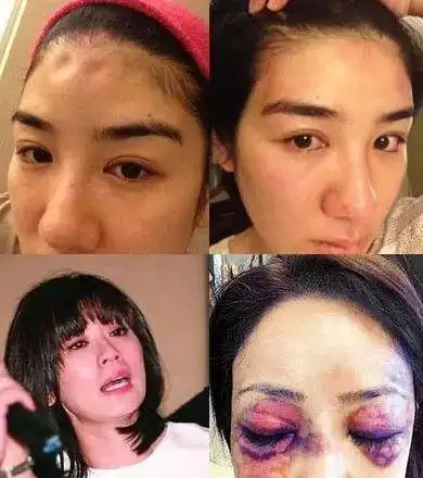 实录她记录下被家暴全过程引数百万网友围观简直丧心病狂