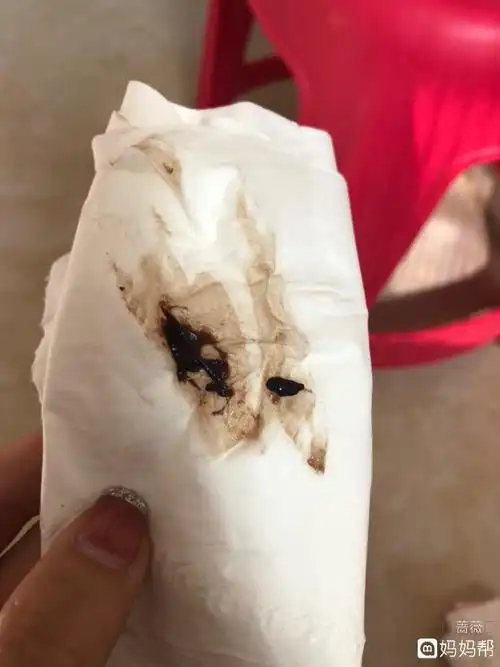 晴朗!排卵期出血怎么治疗"和和美美"-第2张图片-渝北博客