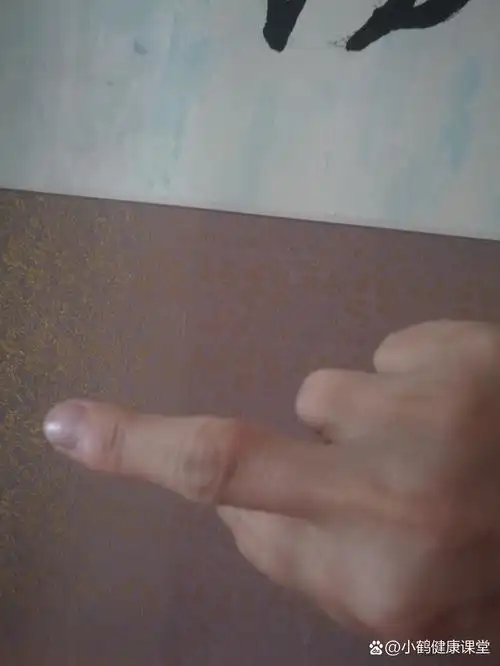 右手中指关节长个小包是什么 最近发现手指关节长个小包,不痛不痒的