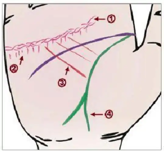 洗澡后手掌易起纹,金星丘靠下部位比较松懈;月丘上主水难的横线比较深