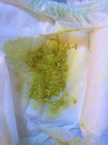 宝宝大便这样正常么?