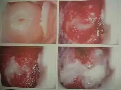 和男人有关的六种妇科病