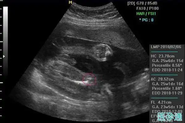 nt上有3个亮点是男孩专家说不靠谱