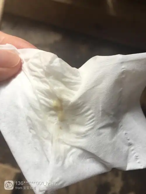各位妈妈帮看看这个白带正常吗?