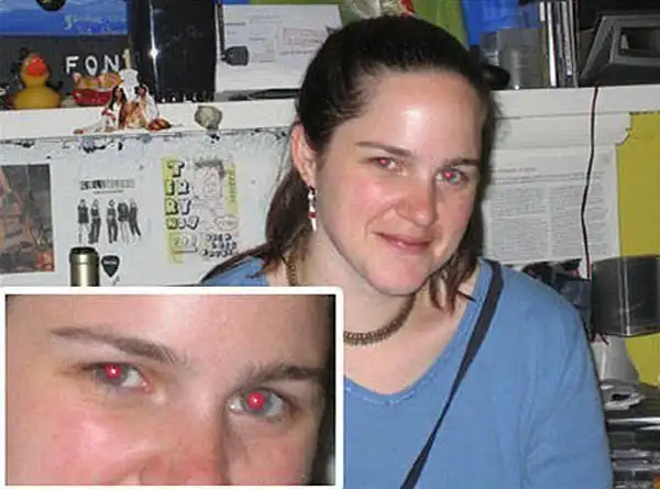 知其然知其所以然 红眼缘由及消除法解析