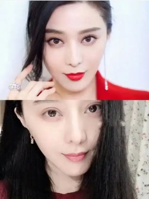 这双"狐狸"大眼更是增色不少,平行宽式双眼皮,宽度在8-10mm左右,开