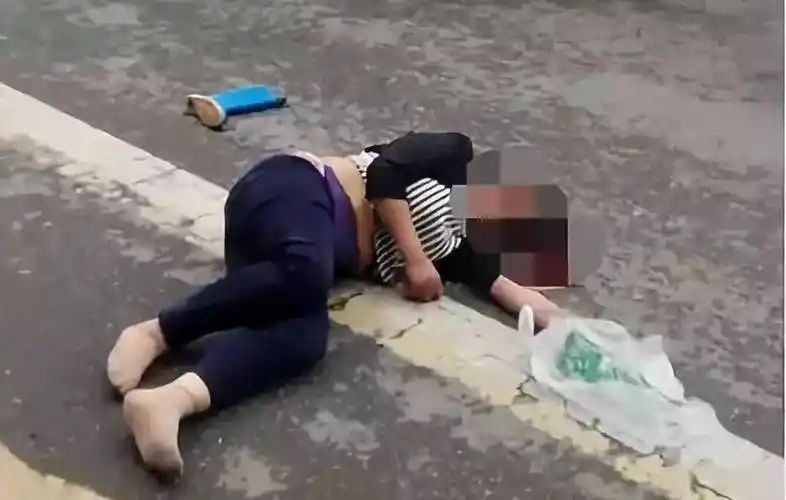 相撞致摩托车倒地,车上两人均不同程度受伤,其中一位女士伤势较为严重