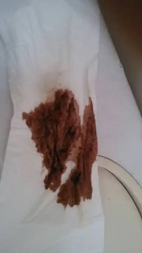 我的月经是不是不正常第一天来这种颜色的,第二天就正常,第三天又第