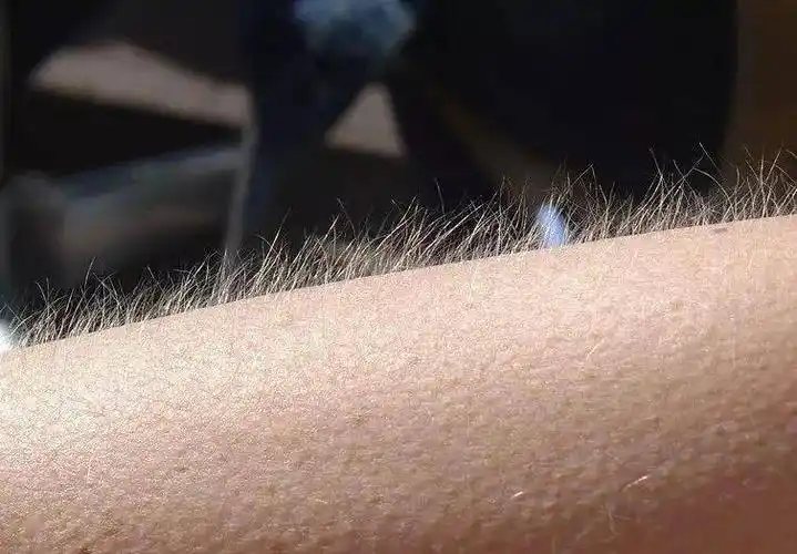 【科普】会起"鸡皮疙瘩"的人好处多!女性更强烈