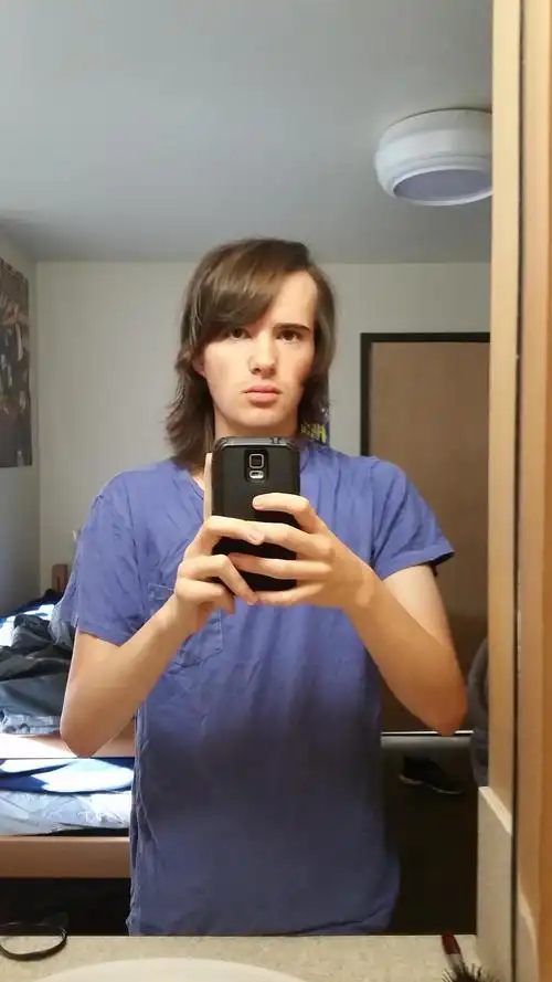 图中是西格尔在服用雌激素当天拍下的照片.