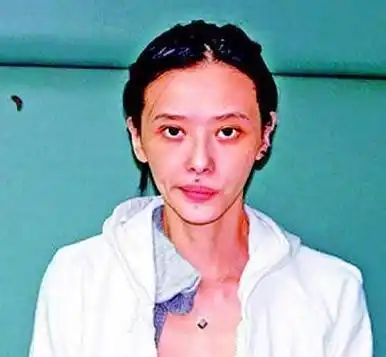 明星吸毒前后对比照不仅前途尽毁容貌更是触目惊心