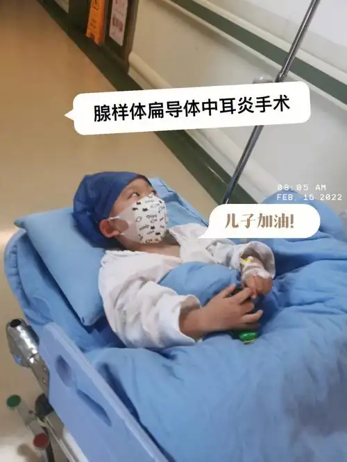三岁腺样体扁导体中耳炎手术