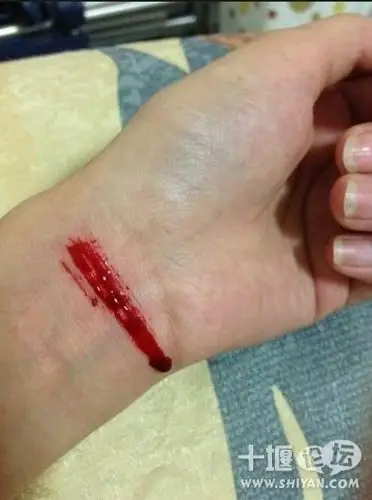 贱人就是矫情失恋了就割脉自残这女人是不是脑残