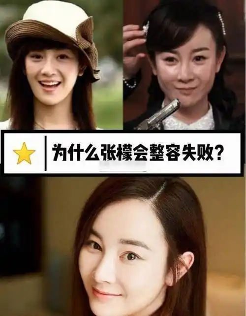 9年前最红的她因整容成为网红无戏可拍_张檬_唐嫣_戚薇