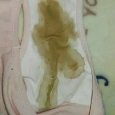 气得哭一晚上没睡,今天一天没吃饭又哭了一天,晚上流了大量褐色分泌物