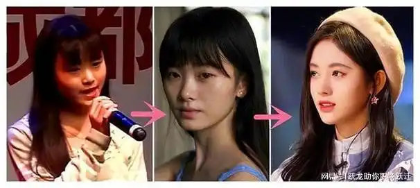 瘦到病态,动脸成瘾,强行装嫩,内娱的"畸形审美"真是刷新三观|金晨