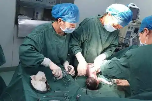 产妇分娩双胞胎平安顺利宝爸因为医生的一句话高兴不起来为何