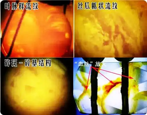 琥珀蜜蜡天然流淌纹的天然秘密