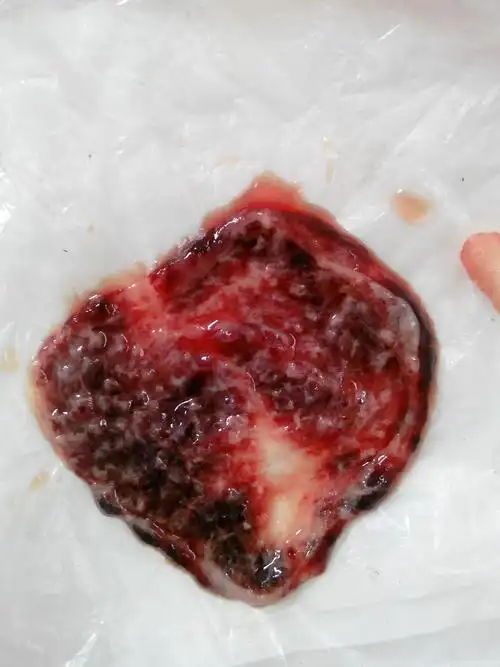 停经51天了 中午上厕所的时候下掉的一块东西 请问