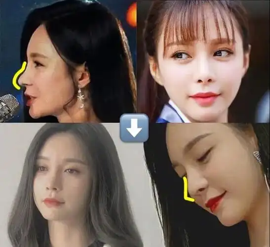 从侧面鼻头形状怪异的猪鼻子变成女团标准脸,沈梦辰的变化很有借鉴
