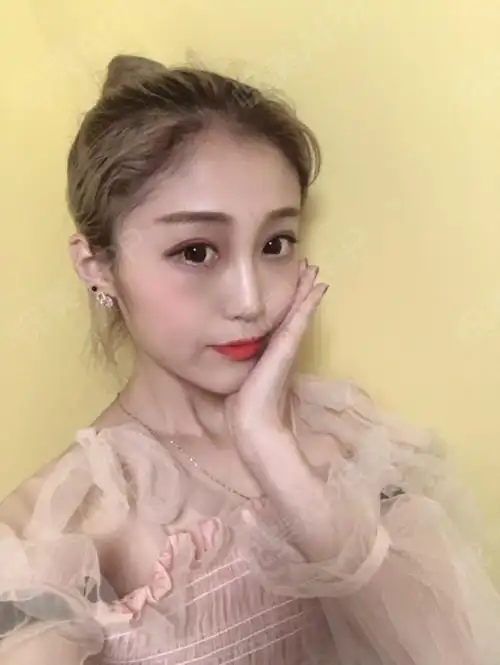 鼻综合整形术后140天_硅胶假体隆鼻术后140天_膨体假体隆鼻术后140天