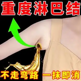 1【一抹就消】淋巴疏通神器腋下排毒颈部理疗消除贴腋下淋巴散结膏