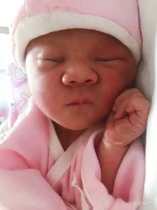 刚刚出生的时候,婴儿的皮肤呈暗蓝色,一开始呼吸就会回复正常肤色胎儿