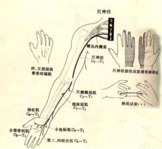 不小心磕到手肘,为什么会麻到没知觉?这个原因要注意了_腾讯新闻