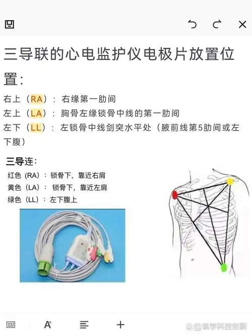 一分钟学会心电监护仪导联放置  93嗨,我是小护士小肖07 --- 95