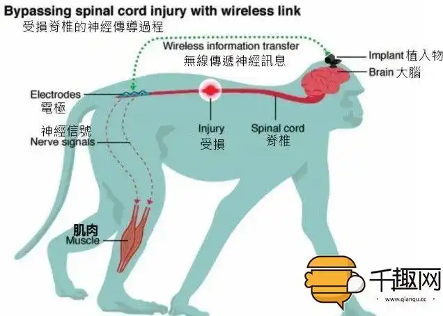 种新型的无线装置,这种装置可以让大脑传出无线讯号,让脊椎断裂的猴子