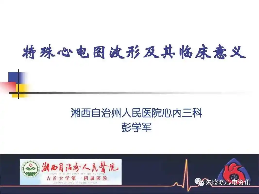 特殊心电图波形及其临床意义 - 抖音
