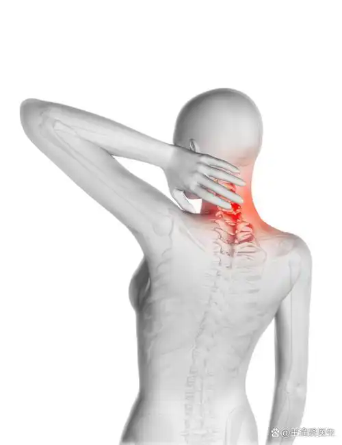 等,如阿司匹林,对乙酰氨基酚等,注意积极主动锻炼,选择合适的颈椎枕头