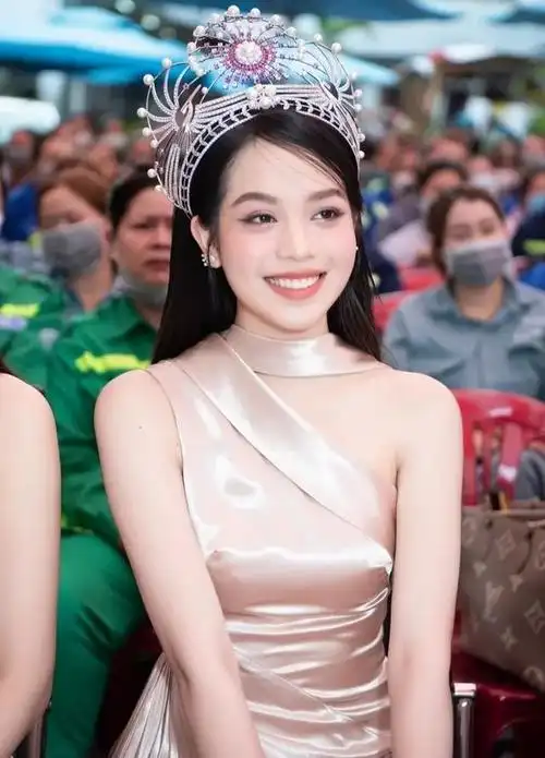 选美冠军小姐鼻子遭质疑,面部疑似有整容迹象