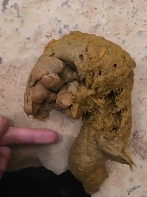 为什么屎由内到外排出再粗也不疼而从外往里捅就不一样了