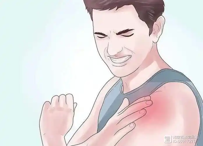 一般来说的话,肩周炎患者主要是三角肌区这个部位疼痛,这个部位也就是