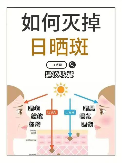 日晒斑77五月不防晒六月斑上来丨干货来啦