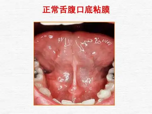 口腔护理及操作ppt
