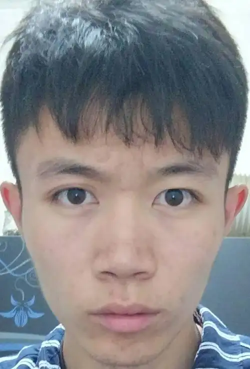 成长值) 8个回答 热心网友  2018-06-19   展开全部 你到底是有多自卑