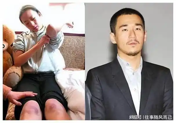 2012年,警方接到群众举报,将在顺义别墅里吸毒的张默当场抓获,人赃并