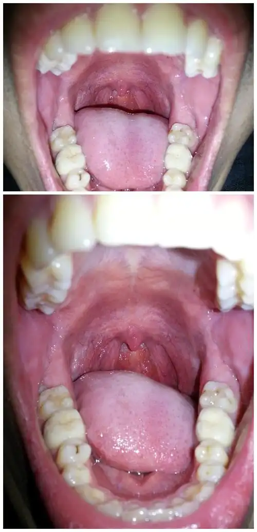 谁能帮我看一下我的口腔和咽喉