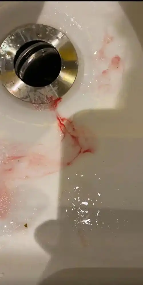 那种痛没人能懂,喝醉酒吐个半死,没人心疼,被反复折磨到死还不 - 抖音