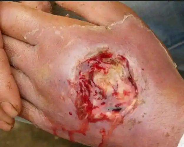 眼镜蛇毒杀无数生物但它咬到自己同样会中毒身亡