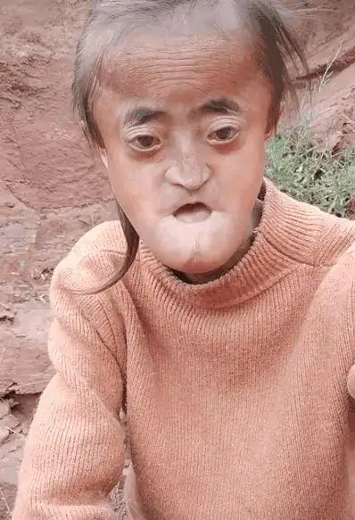 21岁的妹子外表看着却像六七十岁跟自己的奶奶一样